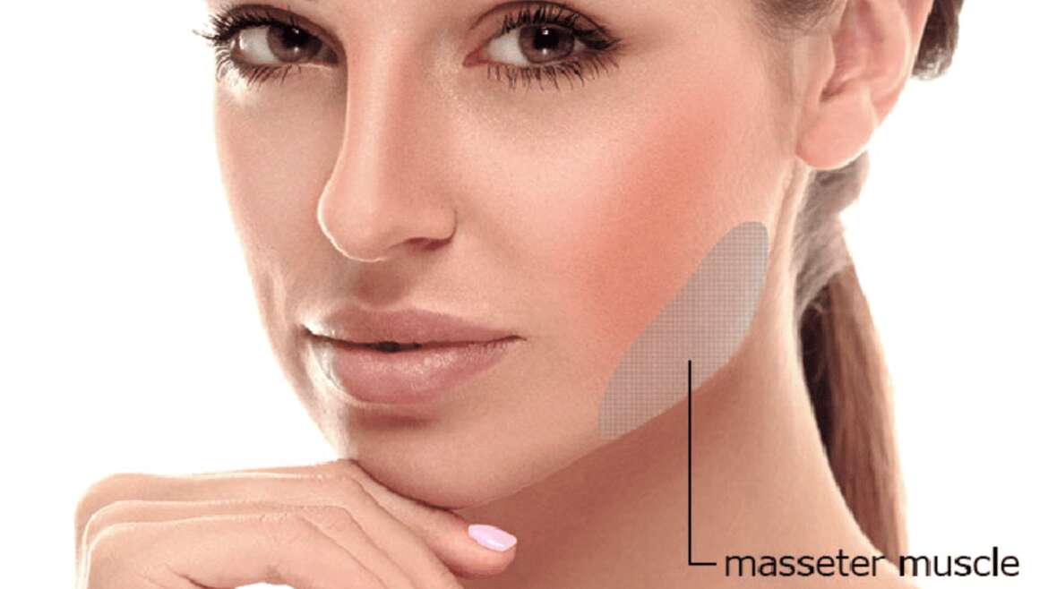 Masseter – Jaw Slimming